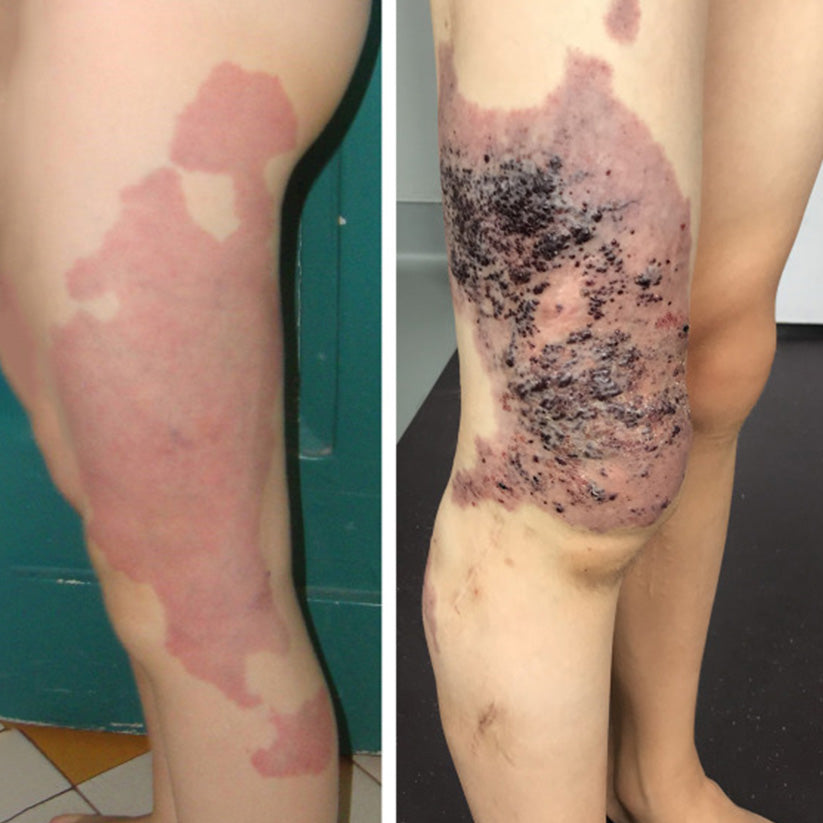 Medazy® HoneyShield Barrier Repair Cream