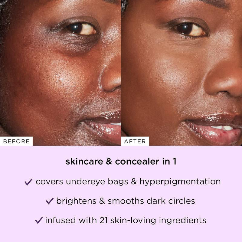 🔥 💥Under-Eye Bags? Dark Spots? This Diamond-Tip Concealer Stick Hugs Contours for Flawless Coverage.