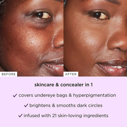 🔥 💥Under-Eye Bags? Dark Spots? This Diamond-Tip Concealer Stick Hugs Contours for Flawless Coverage.