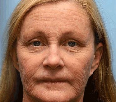 🧠👨‍⚕️Made and shipped from the USA 💫Lovilds® Botin & Vita-A Retinol Shot Wrinkle-Lift Tightening cream - Last Day Promotion 50% OFF